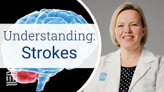 Stroke Causes Risk Factors Treatment and Prevention  Mass General Brigham