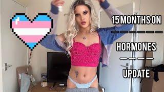 Transgender MTF  15 MONTHS HRT update 