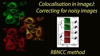 Colocalisation in ImageJ  correcting noisy poor quality images