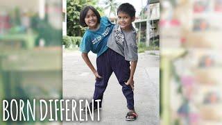 The Conjoined Twins Who Dont Want To Separate  BORN DIFFERENT