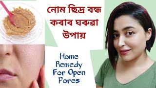 Home Remedy For Open Pores  Assamese Skin Care Tips