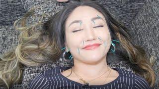 Facial Acupuncture By Dr. Jennifer Ng  New York Live TV