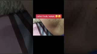 Cukurcabut bulu istri sambil tiduran _ Ketek-Ketiak wanita