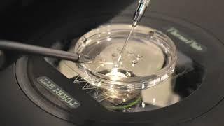 The Process of Intracytoplasmic Sperm Injection for IVF