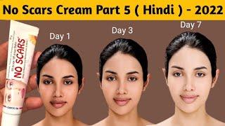 No Scars Cream Part 5  Hindi  - 2022 नो स्कार्स क्रीम भाग - ५ हिंदी में  २०२२ 