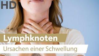 Ständig geschwollene Lymphknoten? Mögliche Ursachen und Hilfe