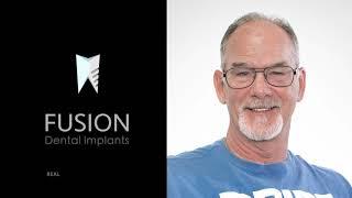 Video Testimony of Fusion Dental Implants Patient