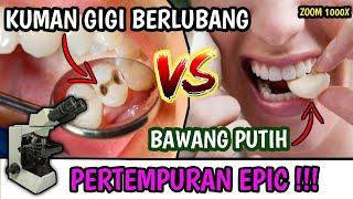 ZOOM 1000X  KUMAN GIGI BERLUBANG VS BAWANG PUTIH CAVITY VS GARLIC UNDER MICROSCOPE  MUJARAB ???