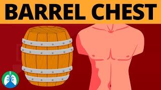 Barrel Chest Medical Definition  Quick Explainer Video