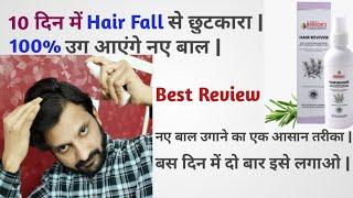 Hair Fall & Baldness Best Homoeopathic Medicine & Hair Oil Baksons Hair Reviver Hair Spray