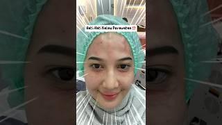 NGERI‼️ JANGAN SAMPE SALAH PERAWATAN treatment? Derma Express aja #Cakepterjangkau #DermaExpress