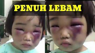 Lagi Viral.. Kekerasan Pada Anak Kembali Terjadi