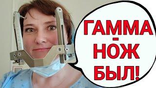 Как все прошло. Первый день после гамма-ножа. Сколько метастазов убрали?