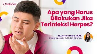 Apa yang Harus Dilakukan Jika Terinfeksi Herpes?