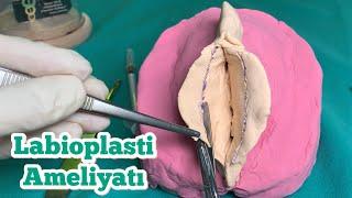 ️ Labioplasti Ameliyatı Nedir?  İç Dudak Estetiği Şekli Nasıl Olmalı?  Labiaplasty Turkey Antalya