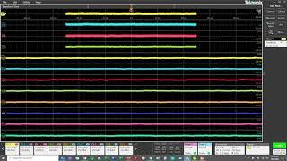 How to Set Up Multi-Scope Analysis on TekScope PC Software