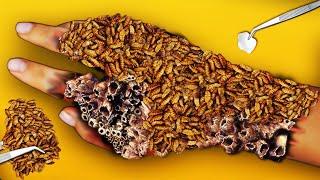 ASMR video Animation Remove the big worm from the students hand Treatment animation 2D