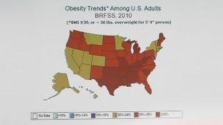 Obesity in America Diet Drugs or Surgery?