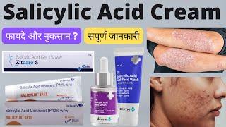 Salicylic acid cream uses in hindi  Salicylic acid cream for acne treatment  Salicylic acid gel