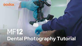 Using Godox  macro flash #MF12 in Dental Photography-- Tutorial