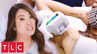 Extreme Hyperhidrosis Dr. Lee Treats Patients Uncontrollable Sweating  Dr. Pimple Popper