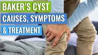 Baker’s Cyst Causes Symptoms Treatment Conservative vs. Surgery