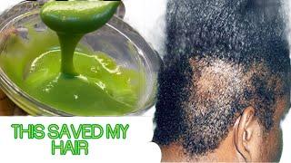 IM SOLD 10X HAIR GROWTH MY END RESULT AFTER THIS HAIR GROWTH RECIPE IS AMAZING April 7 2024