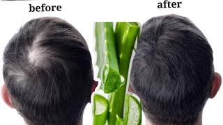 Fast hair growth with aloe Vera the best hair growth and hair thicken recipe #hair #hairgrowth