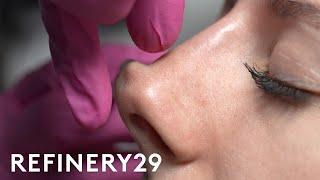 I Tried A Non-Surgical Nose Job  Macro Beauty  Refinery29