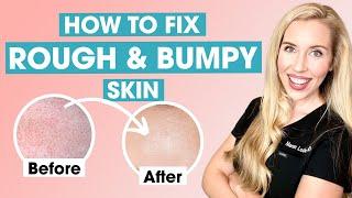 How To Fix Rough and Bumpy Skin  Keratosis Pilaris Affordable Skincare Routine