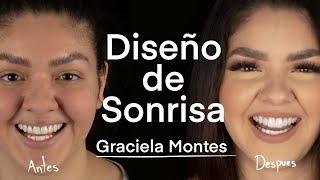 El Cambio Drastico de Graciela Montes