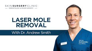 Laser Mole Removal - See The Treatment