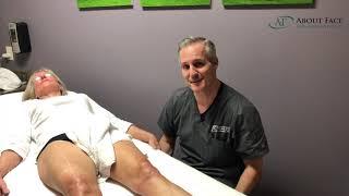 Laser Skin Tightening Video