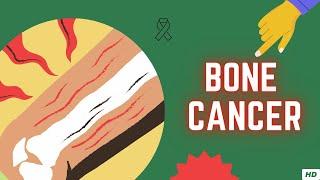 Bone Cancer Causes Signs and Symptoms Diagnosis and Treatment.