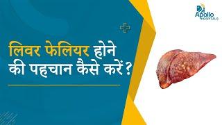 लिवर फेलियर होने की पहचान कैसे करें ?   Dr. Anand Ramamurthy Liver Transplant  Apollo Hospitals