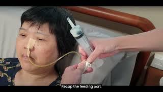 3. Performing Nasogastric Tube NGT Feeding