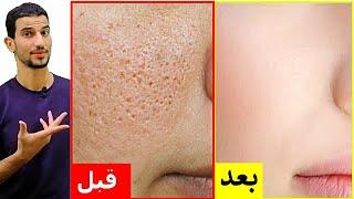 The fastest way to get rid of large pores and oily skin in just 3 days