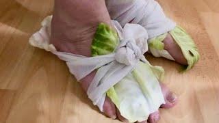 It pulls diseases out of the body like a magnet Cabbage wraps are a cure for swollen joints thyroi