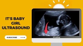 19-Week Baby Girl Ultrasound