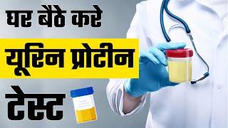 घर बैठे करे यूरिन प्रोटीन टेस्ट  How to do Urine Protein Test at Home  Proteinuria Causes