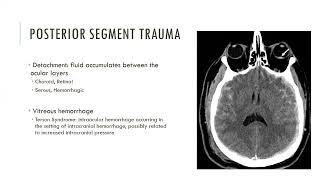 Ocular and Optic Nerve Trauma  Free Radiology CME