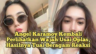 Angel Karamoy kembali perlihatkan wajah usai oplas Hasilnya Tuai beragam reaksi