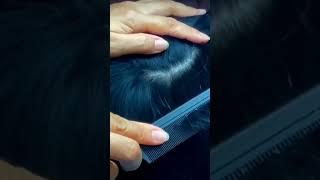 ASMR Scalp Check For Dandruff and  treatment 