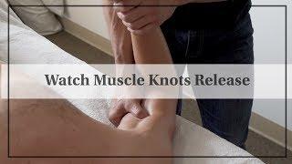 Watch Muscle Knots Being Released  Deep Tissue Massage