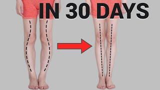 Get Straight Legs in 30 Days Fix O or X-Shaped Legs Knee Internal Rotation