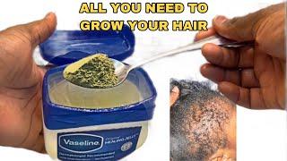 No jokeThis hair growth recipe with VASELINE will be ya last stop 10X ya hair growthApril 5 2024