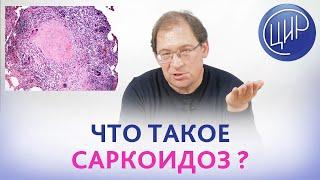 Саркоидоз. Что такое саркоидоз предрасположенность к саркоидозу. Саркоидоз и проблемы репродукции.