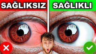 EVDE YAPABİLECEĞİNİZ 10 SAĞLIK TESTİ Akciğer Kapasitesi Sivilcelerin Anlamları Renk Körlüğü