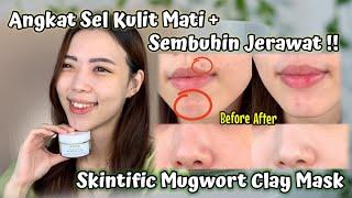 Eksfoliasi untuk Kulit Berjerawat Jangan Salah Pilih Produk  Skintific Mugwort Clay Mask  Sylvia