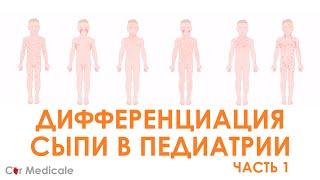 Сыпь в педиатрической практике как правильно поставить диагноз при экзантемных заболеваниях?